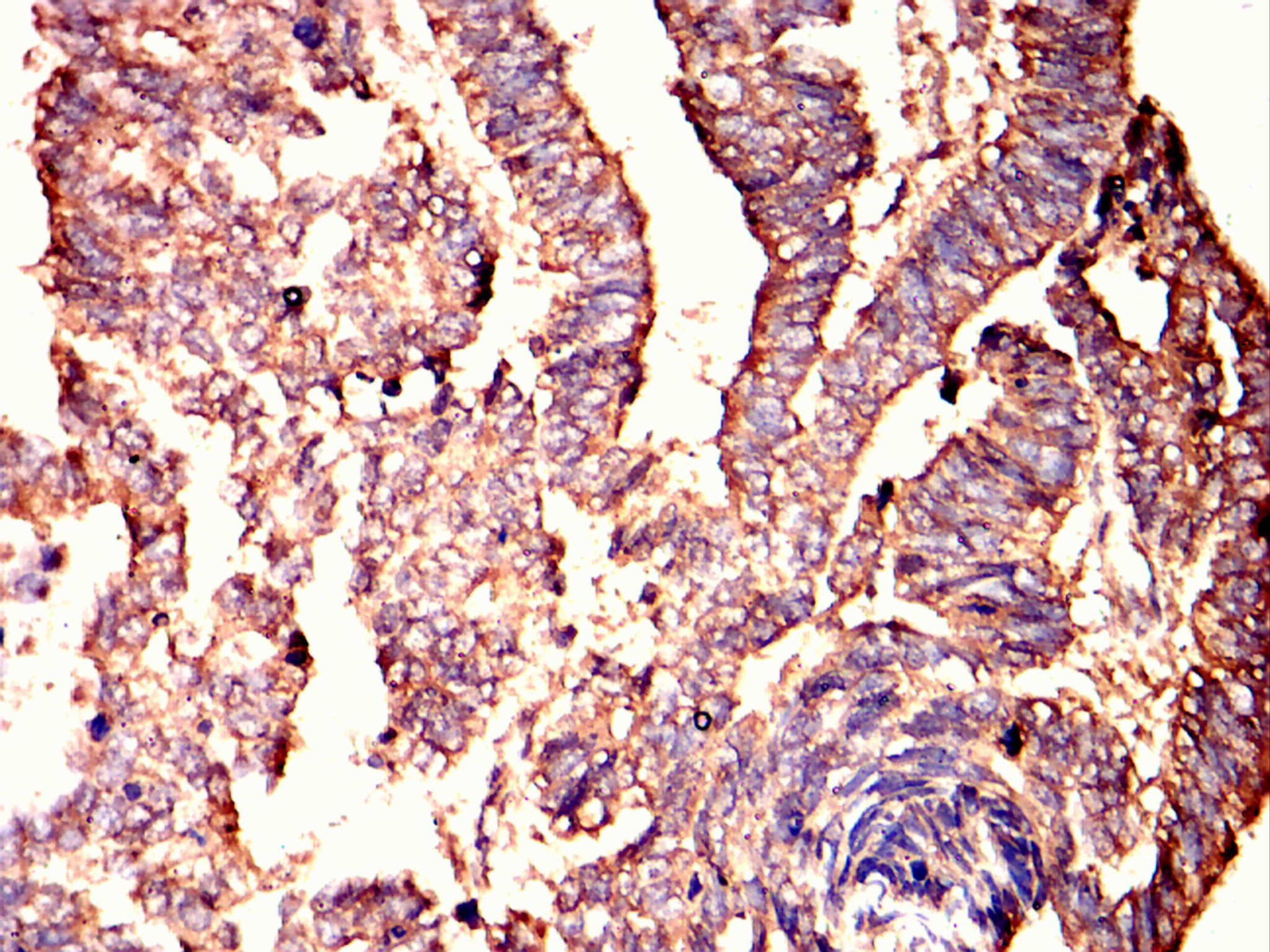 		IHC